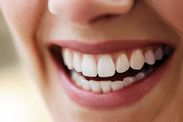 teeth-tooth-white-smile.jpg